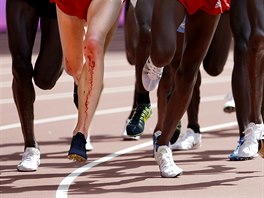 The bloodied legs of United States' Galen Rupp after he was spiked in a mens...