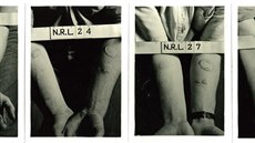 Puch��e u lid� vystaven�ch p�soben� jedovat�ho plynu