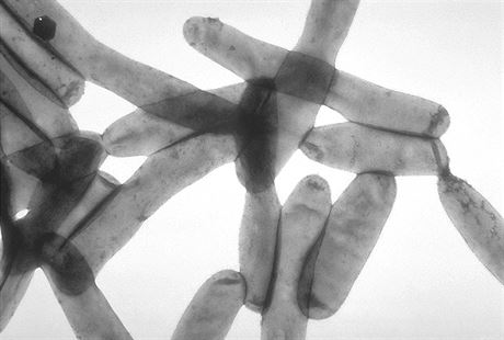 Bakterie legionella pneumophila