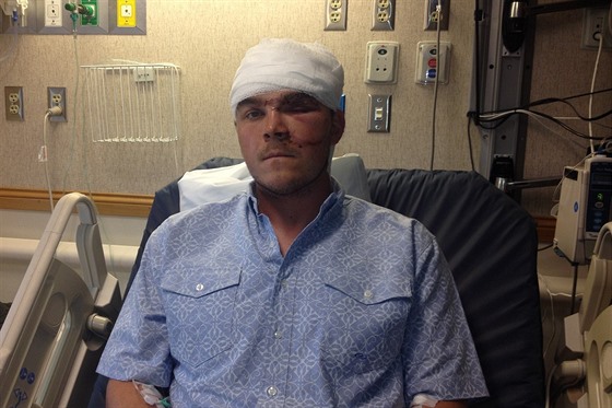 estadvacetiletý Chase Dello skonil po útoku medvda v nemocnici. (4. 10. 2015)