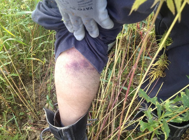 Zranní jednoho ze sbra, které mu ml údajn zpsobit neetrný zásah policie.