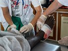 Zdravotnický tým na lodi Phoenix vymuje obvazy na nohách jednoho z pacient.