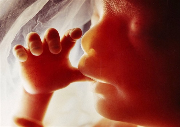 Policisté zřejmě zadrželi lékaře, za kterým jezdily polské ženy na potrat