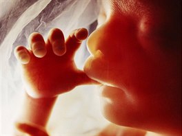 Je�t� nenarozené dít� uvnit� d�lohy. (1965)