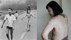 Vietnamka Kim Phuc, její snímek, na kterém je zachycena jako utíkající nahá...