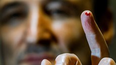 Reportér MF DNES podstoupil diagnostiku z kapky krve.
