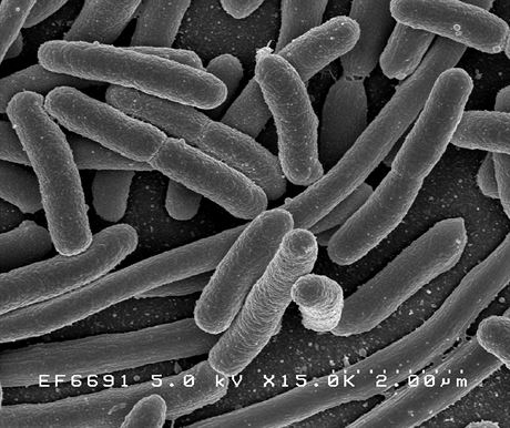 Bakterie Escherichia coli