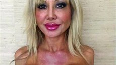 P�tkrát zv�t�ená prsa Blondie Bennettové nesta�í.