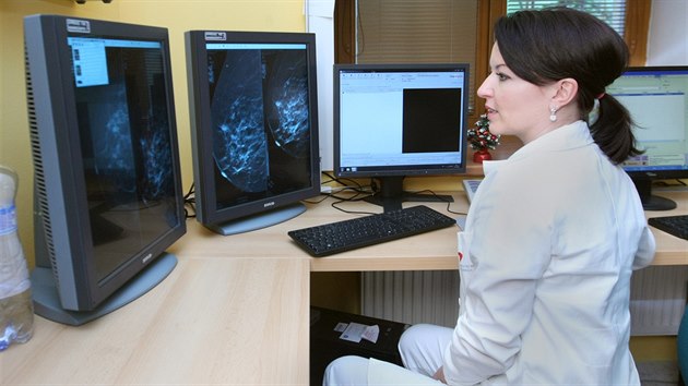 Olomouck fakultn nemocnice pedstavila nov modern mamograf, kter je v esku jen na pti mstech. Podila ho v rmci velk modernizace vybaven v celkov hodnot 112,5 milionu korun.