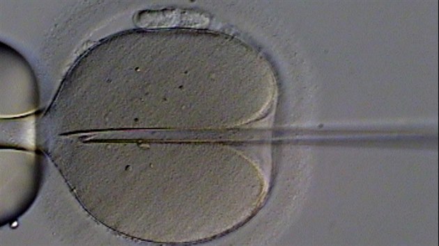 Umělé oplodnění lidského vajíčka injekcí spermie. Nejde o běžnou součást procedury umělého oplodnění, používá se spíše v případech, kdy vajíčko není možné oplodnit klasickou metodou (třeba při snížené pohyblivosti spermií atp.).