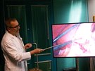 Lékai FN Plze vyoperovali pacientovi luník pomocí 3D techniky