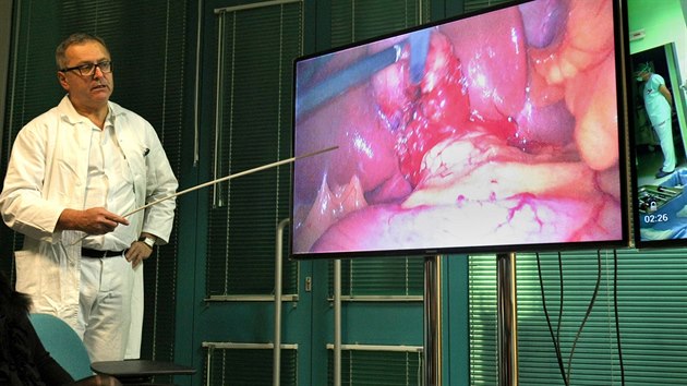 Operaci u dvou obrazovek komentoval pednosta chirugick kliniky Vladislav Teka. (20. ledna 2016)