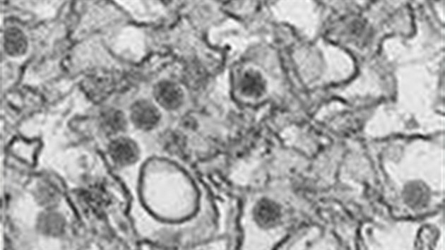 Virus zika, kter podle expert zejm zpsobuje mikrocefalii (23. ledna 2016).