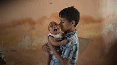 Desetiletý chlapec drí svého dvoumsíního bratra postieného mikrocefalií