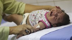 Od roku 2015 bylo v Brazílii zaznamenáno 3893 pípad mikrocefalie u...