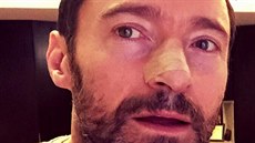 Hugh Jackman oznámil, e se mu u popáté vrátila rakovina ke (8. února 2016).