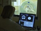 Fakultn nemocnice v Hradci ukzala, co se dje s pacienty pi mozkov mrtvici