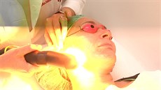 Metoda IPL pro sjednocení a omlazení pleti