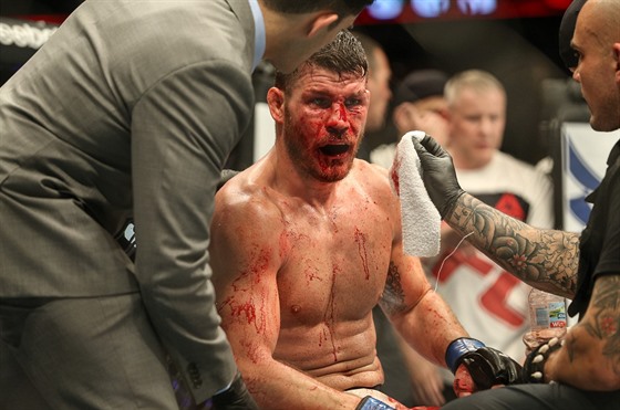 Léka kontroluje zranní bojovníka MMA Michaela Bispinga v zápase UFC proti...
