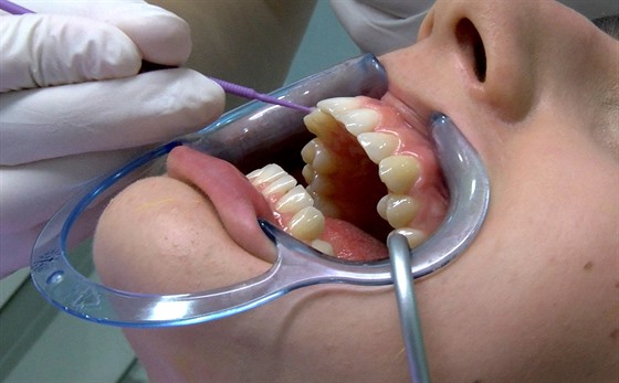 V kraji chybí ortodontisté. Rodie, kteí chtjí své dti objednat na vyetení, musejí ekat i déle ne rok. (ilustraní snímek)