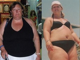Morbidn obézním enám se podailo zhubnout.