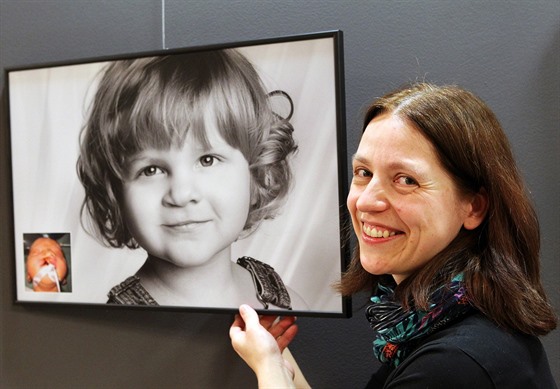Výstava fotografií dětí narozených s rozštěpovou vadou v obličeji je k vidění...
