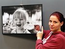 V�stava fotografi� d�t� narozen�ch s roz�t�povou vadou v obli�eji je k vid�n�...