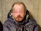 Bezdomovec, zranný v Platnéské ulici v Praze byl pevezen k oetení do...