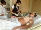 Rodrigo Alves po jedné z mnoha plastických operací.
