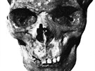 Lebka Karla IV na snímku z roku 1977 nese stopy rzných váných poranní z...