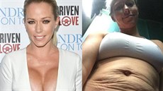 Kendra Wilkinsonová ukázala, jak vypadala její k��e na b�i�e po porodu.