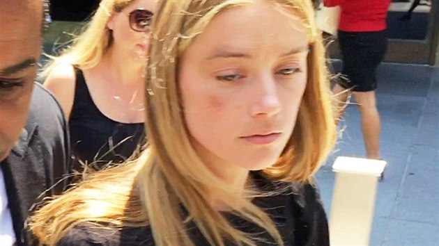 Amber Heardov s modinou pod okem odchz od soudu (Los Angeles, 27. kvtna 2016)