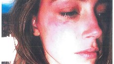 Amber Heardová obvinila Johnnyho Deppa z domácího násilí.