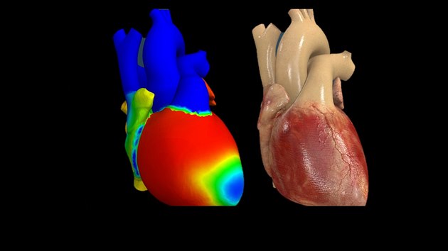 Projekt Living Heart zobrazuje srdce v pohybu. V budoucnu by vědci rádi chtěli umět vytvořit simulaci srdce každého pacienta.