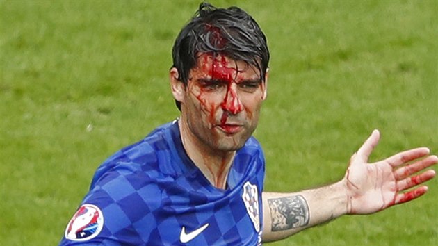 Takhle vypadal chorvatsk obrnce Vedran orluka po jednom z ostrch souboj s fotbalisty Turecka.