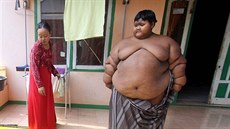 Arya Permana je extrémně obézní chlapec.