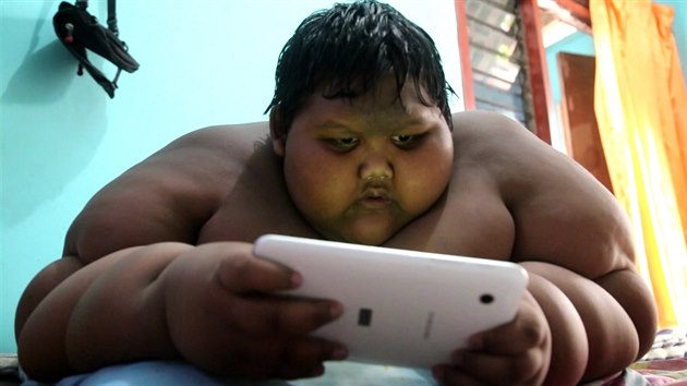 Morbidně obézní chlapec z Indonésie váží v deseti letech 192 kilogramů -  iDNES.cz
