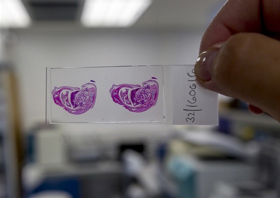 Myí embryo (30. 6. 2016).