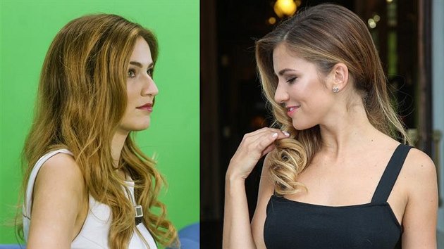 esk Miss 2016 Andrea Bezdkov ped plastikou nosu (vlevo) a po zkroku (vpravo)