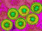 Virus Varicella zoster, který zpsobuje pásový opar a plané netovice.