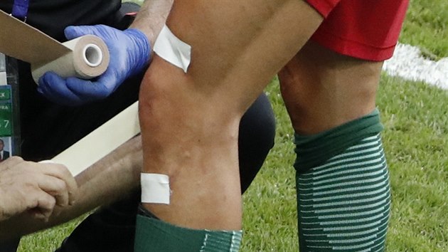 MARNÁ SNAHA. Lékaři se pokoušeli Ronaldovi koleno zafixovat, na chvíli se vrátil do hry, ale pokračovat ve finále Eura nemohl.