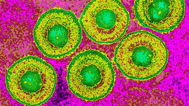 Virus Varicella zoster, který způsobuje pásový opar a plané neštovice.