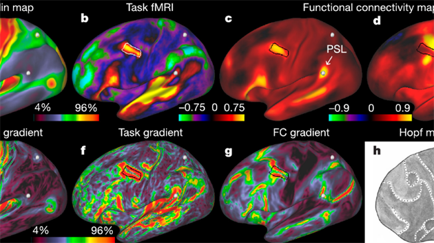 Mapování mozku pomocí funkční magnetické rezonance a dalších metod