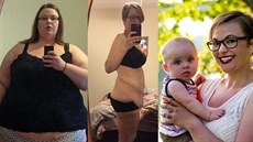 Monica Kinde byla velmi obézní, dnes u tlouku pipomínají jen jizvy po...