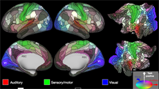 „Rozparcelování“ mozku na oblasti podle jejich zaměření