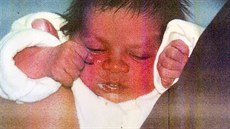 Zephany Nurseová krátce po svém narození. Po tech dnech v porodnici byla...