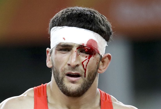 Ruský zápasník Aniuar Gedujev krvácí bhem olympijského finále proti Hassanu...
