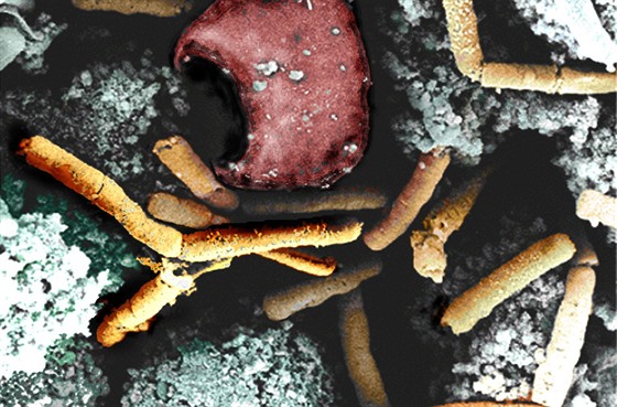 Bakterie antraxu (žluté tyčinky) napadají opičí plicní tkáň. Snímek je falešně...