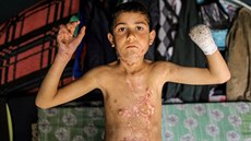 Jedna z mnoha obtí. Tehdy trnáctiletého syrského chlapce Shyara Ahmada...