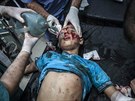 Dít zranné pi vládní náletech na Aleppo eká na oetení v jedné z místních...